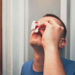 person with nosebleed
