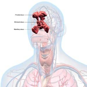 overview of sinusitis