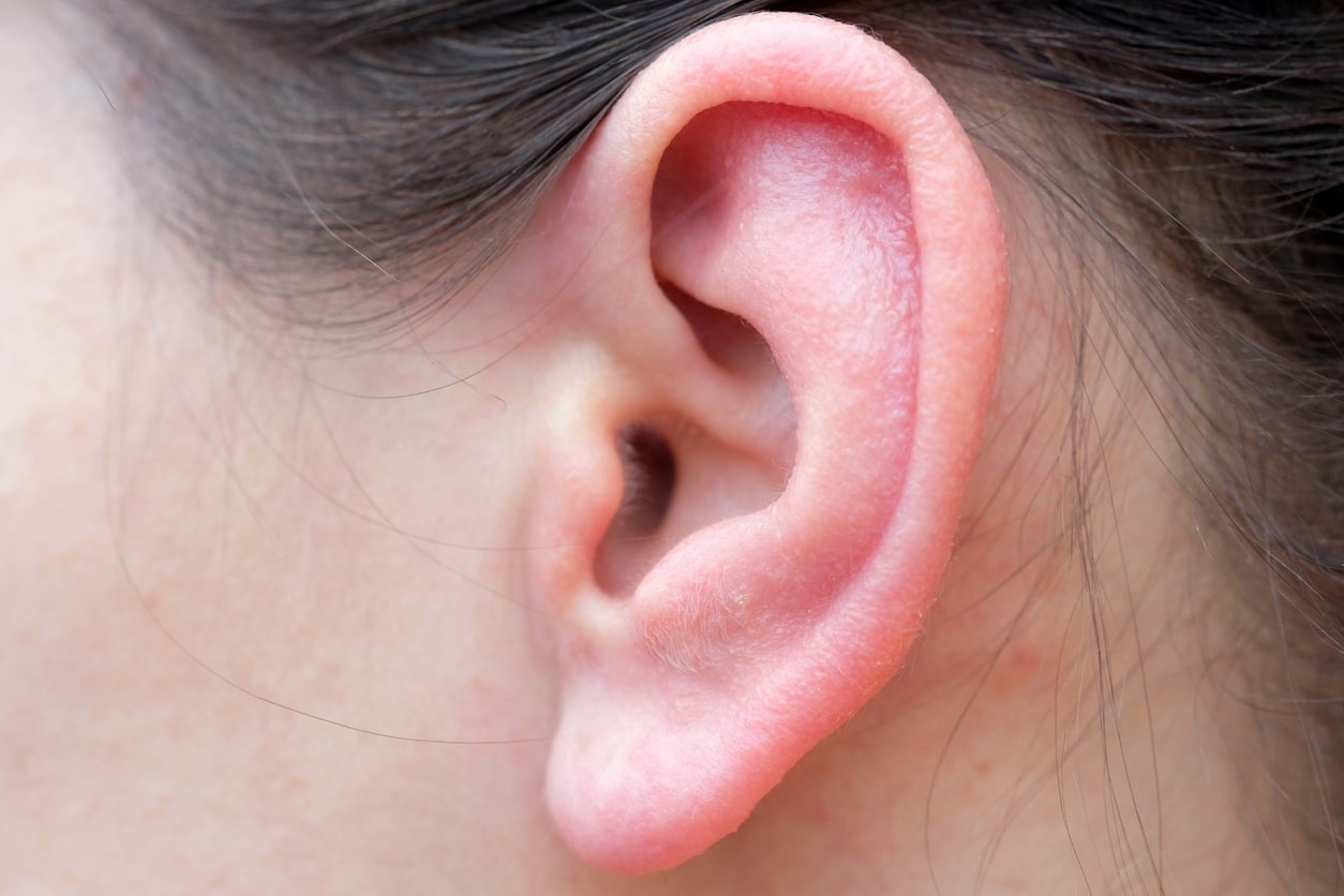 Close-up of dry, irritated ear